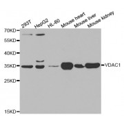 Western blot analysis of extracts of various cell lines, using VDAC1 antibody (abx000866) at 1/1000 dilution.