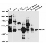 Western blot analysis of extracts of various cell lines, using PDK1 antibody (abx000875) at 1:3000 dilution.
