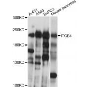 Western blot analysis of extracts of various cell lines, using ITGB4 antibody (abx000880) at 1/1000 dilution.