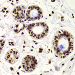 X-Ray Repair Cross Complementing 6 (XRCC6) Antibody