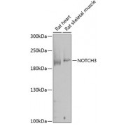 Western blot analysis of extracts of rat heart and skeletal muscle, using NOTCH3 antibody (1/1000 dilution).