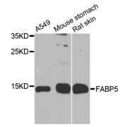 Western blot analysis of extracts of various cell lines, using FABP5 antibody (abx000909) at 1/1000 dilution.