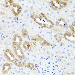 Fatty Acid Binding Protein 5, Epidermal (FABP5) Antibody