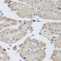 Fatty Acid Binding Protein 5, Epidermal (FABP5) Antibody