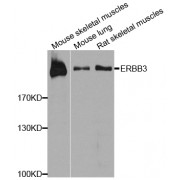Western blot analysis of extracts of various cell lines, using ERBB3 antibody (abx000910) at 1/1000 dilution.