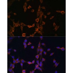 Calcineurin Subunit B Type 1 (PPP3R1) Antibody