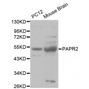 Western blot analysis of extracts of various cell lines, using PRKN antibody (1/1000 dilution).
