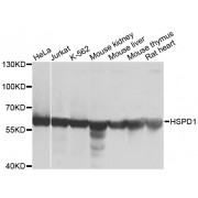 Western blot analysis of extracts of various cell lines, using HSPD1 antibody (abx000922) at 1/1000 dilution.