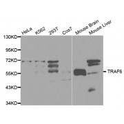 Western blot analysis of extracts of various cell lines, using TRAF6 antibody (abx000926) at 1/1000 dilution.