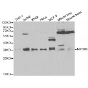 Western blot analysis of extracts of various cell lines, using MyD88 antibody (abx000933) at 1/1000 dilution.