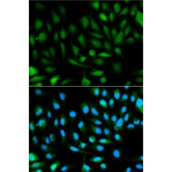 High Sensitive Parkinson Disease Protein 7 (PARK7) Antibody