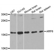 Western blot analysis of extracts of various cell lines, using ARF6 antibody (abx000941) at 1/1000 dilution.