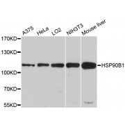 Western blot analysis of extracts of various cell lines, using HSP90B1 antibody (abx000942) at 1/1000 dilution.