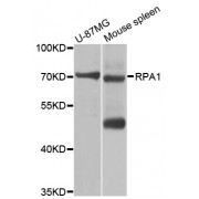 Western blot analysis of extracts of various cell lines, using RPA1 antibody (abx000943) at 1/1000 dilution.