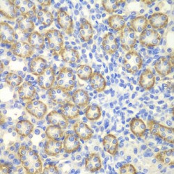 Synaptotagmin 1 (SYT1) Antibody