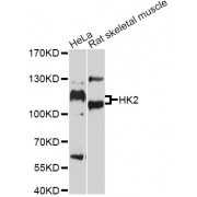 Western blot analysis of extracts of various cell lines, using HK2 antibody (abx000947) at 1/1000 dilution.