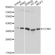 Western blot analysis of extracts of various cell lines, using CCNH Antibody (abx000948).