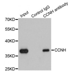 Cyclin-H (CCNH) Antibody