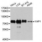 Western blot analysis of extracts of various cell lines, using YAP1 antibody (abx000954) at 1/1000 dilution.
