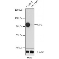 Yes-Associated Protein 1 (YAP1) Antibody