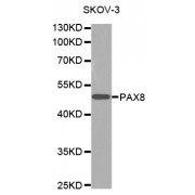 Western blot analysis of extracts of SKOV3 cells, using PAX8 antibody (abx000957).