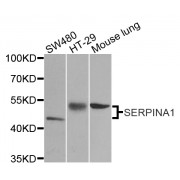 Western blot analysis of extracts of various cell lines, using SERPINA1 antibody (abx000959) at 1/1000 dilution.