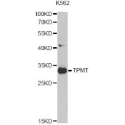 Western blot analysis of extracts of K562 cells, using TPMT antibody (abx000960) at 1/1000 dilution.