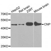 Western blot analysis of extracts of various cell lines, using CNP antibody (abx000961) at 1/1000 dilution.