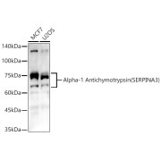 Western blot analysis of various lysates, using  SERPINA3 antibody (1/400 dilution).