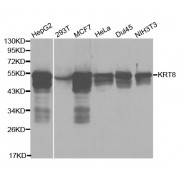 Western blot analysis of extracts of various cell lines, using KRT8 antibody (abx000965) at 1/1000 dilution.