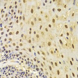 Keratin, Type II Cytoskeletal 8 (KRT8) Antibody