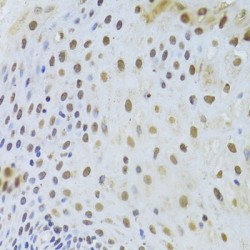 Keratin, Type II Cytoskeletal 8 (KRT8) Antibody