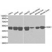Western blot analysis of extracts of various cell lines, using SGK1 antibody (abx000966) at 1/1000 dilution.