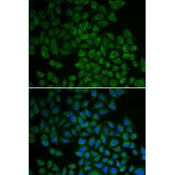 Serine/Threonine-Protein Kinase Sgk1 (SGK1) Antibody