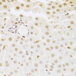14-3-3 Protein Sigma (SFN) Antibody
