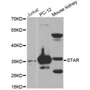 Western blot analysis of extracts of various cell lines, using STAR antibody (abx000970) at 1/1000 dilution.