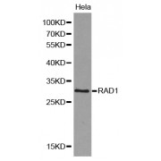 Western blot analysis of extracts of HeLa cells, using RAD1 antibody (abx000974).