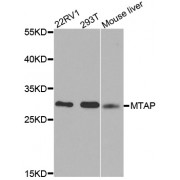 Western blot analysis of extracts of various cell lines, using MTAP antibody (abx000975) at 1/1000 dilution.