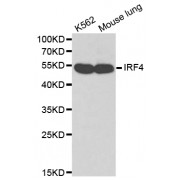Western blot analysis of extracts of various cell lines, using IRF4 antibody (abx000976).