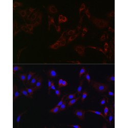 Hexokinase 1 (HK1) Antibody