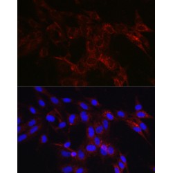 Hexokinase 1 (HK1) Antibody