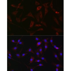 Hexokinase 1 (HK1) Antibody