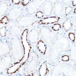 Hexokinase 1 (HK1) Antibody