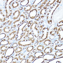 Hexokinase 1 (HK1) Antibody