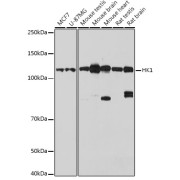 Western blot analysis of extracts of various cell lines (25 µg per lane), using HK1 antibody (1/1000 dilution) followed by <a href="https://www.abbexa.com/index.php?route=product/search&search=abx005548" target="_blank">abx005548</a> - Goat Anti-Rabbit IgG, H+L (1/10000 dilution) and 3% non-fat dry milk in TBST for blocking.