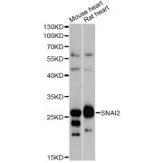 Western blot analysis of extracts of various cell lines, using SNAI2 antibody (abx000980) at 1/1000 dilution.