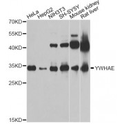 Western blot analysis of extracts of various cell lines, using YWHAE Antibody (abx000981) at 1/1000 dilution.