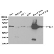 Western blot analysis of extracts of various cell lines, using PPP3CA antibody (abx000986) at 1/1000 dilution.