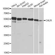 Western blot analysis of extracts of various cell lines, using CALR antibody (abx000989) at 1/1000 dilution.