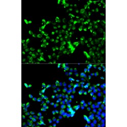 Calreticulin (CALR) Antibody